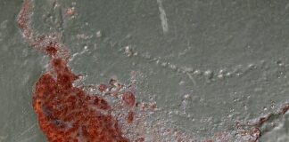 Co to znaczy mieć wysokie podbicie?