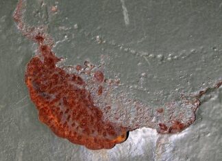 Czy wysokie podbicie to wada?